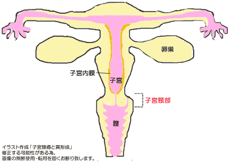 子宮頸管培養の目的は何ですか?